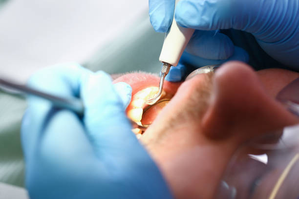 Best Mobile Emergency Dentist in New Cumberland, PA